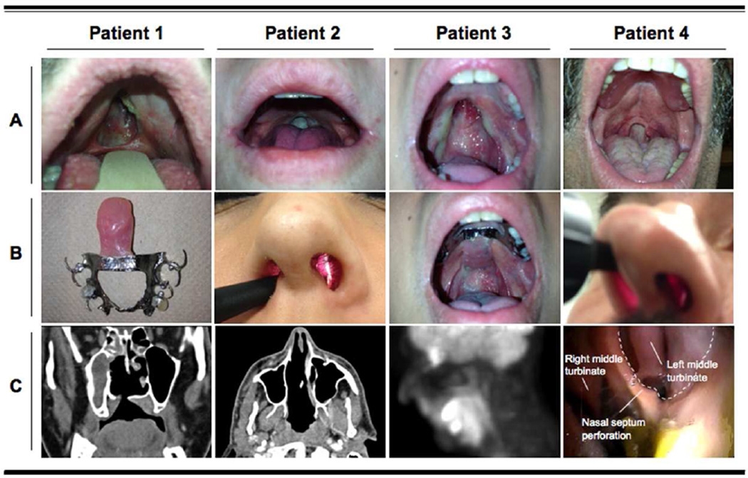 plastic surgeon rhinoplasty